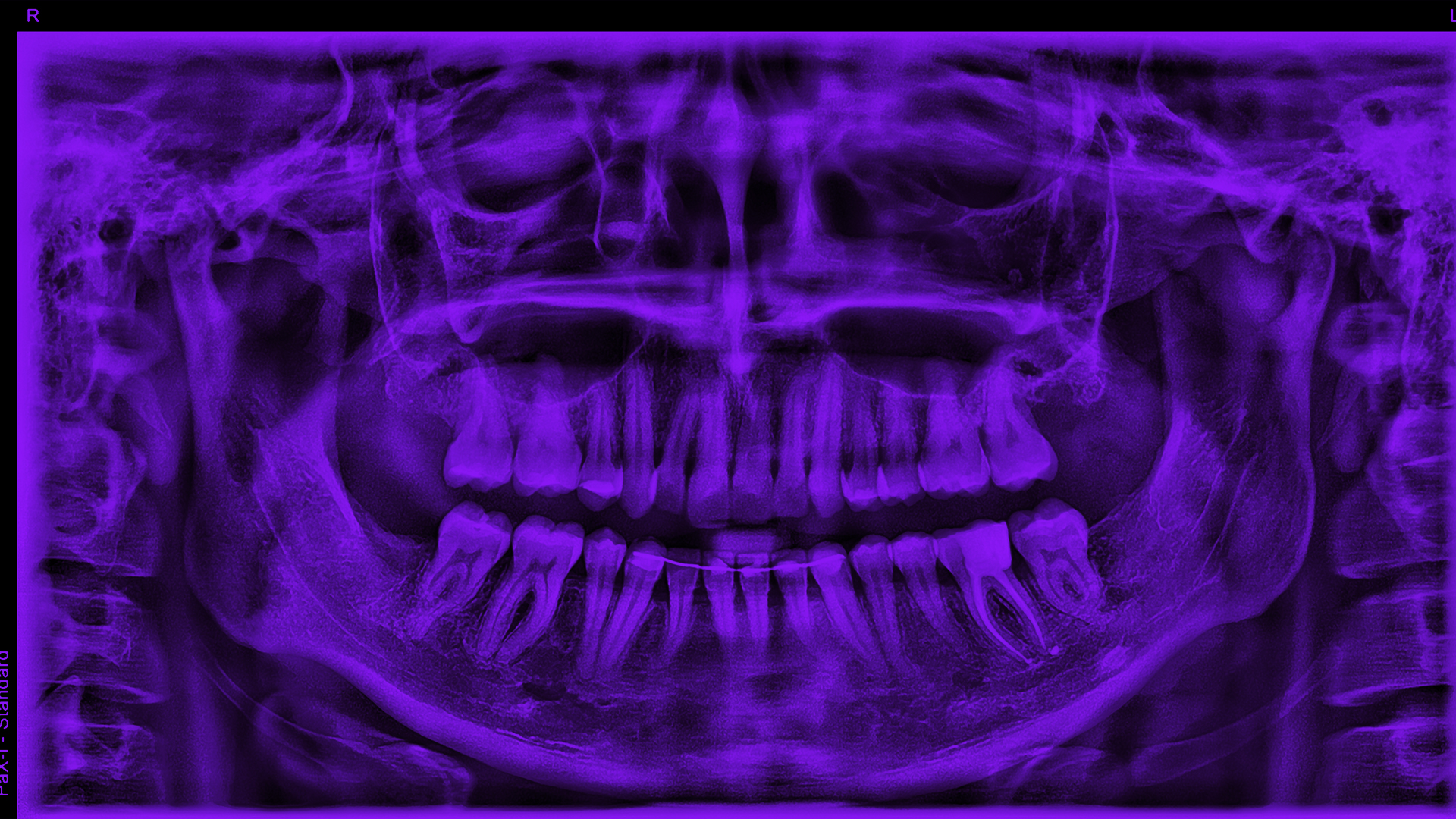 What are we fighting for?